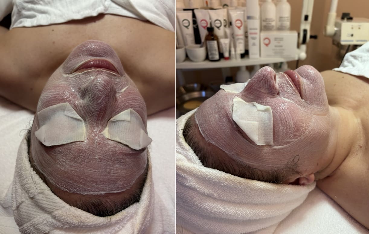 Pevonia Micro-Retinol Essential Peel Treatment